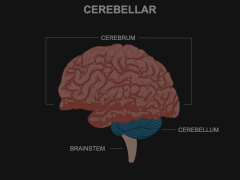 Cerebellar Animated Presentation - SketchBubble