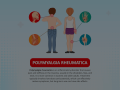 Polymyalgia Rheumatica (PMR) Animated Presentation - SketchBubble