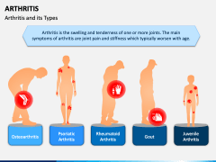 Arthritis PPT Slide 1