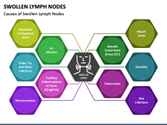 Swollen Lymph Nodes PPT Slide 2
