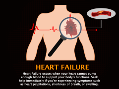 Heart Failure PowerPoint Template and Google Slides Theme