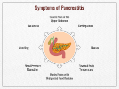 Pancreatitis PowerPoint and Google Slides Template - PPT Slides