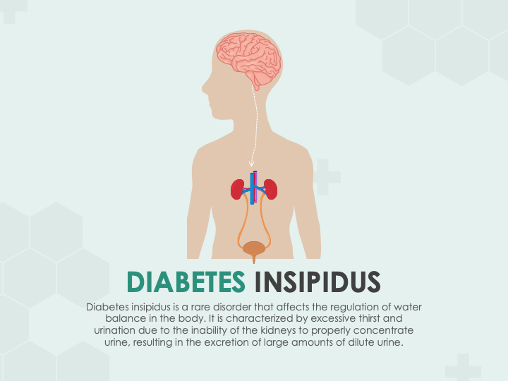 Diabetes Insipidus PPT Slide 1