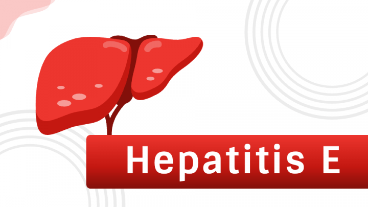 Hepatitis E PPT Slide 1