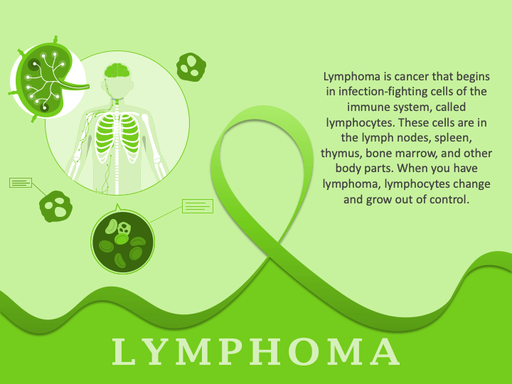 Lymphoma PPT Slide 1