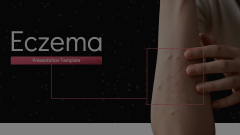 Eczema Animated Presentation - SketchBubble
